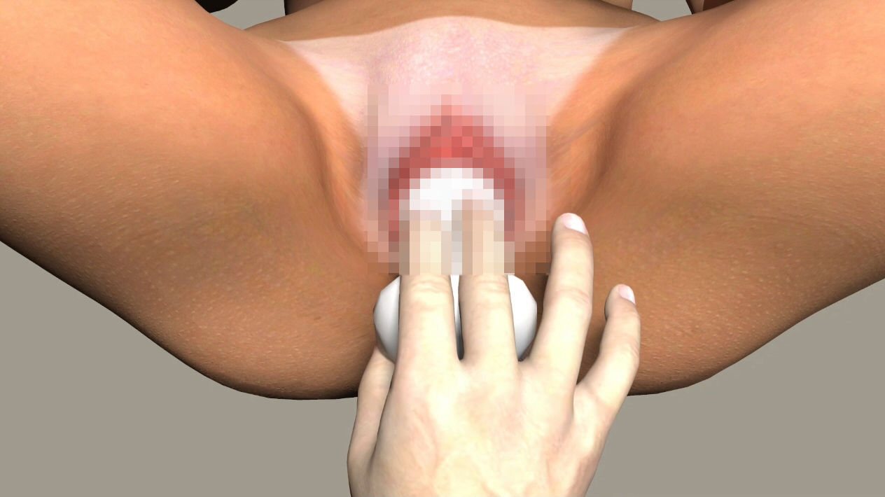 サンプル画像5:Sequence2(EROPO) [d_139868]