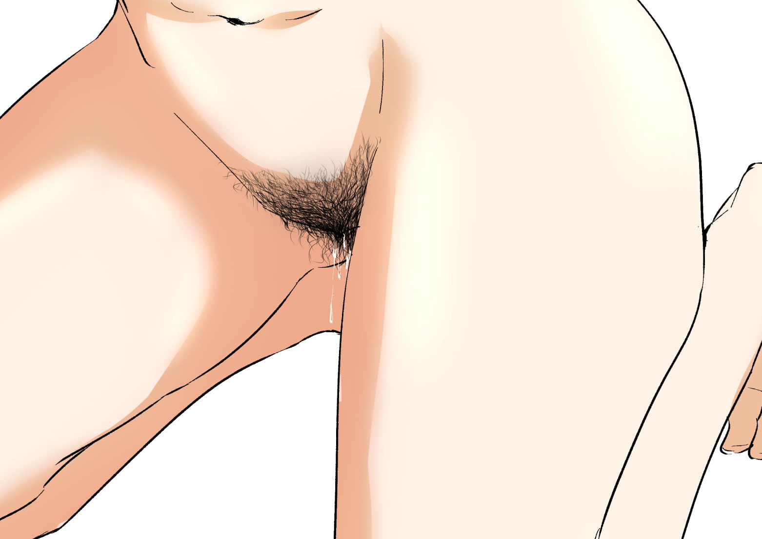 サンプル画像3:毛の処理レポートアカデミア(毛想家 ワキミウンテン) [d_185444]