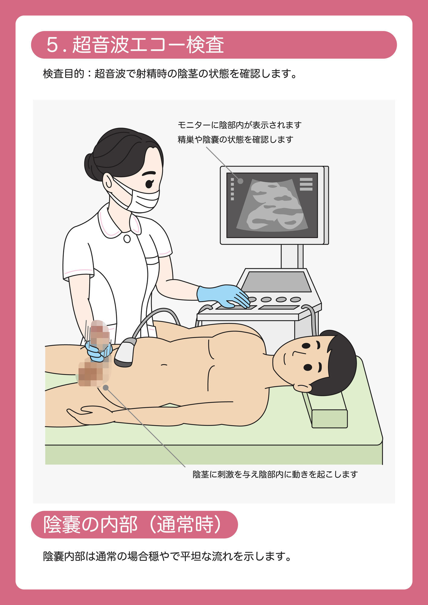 陰茎健診のご案内のサンプル画像 6