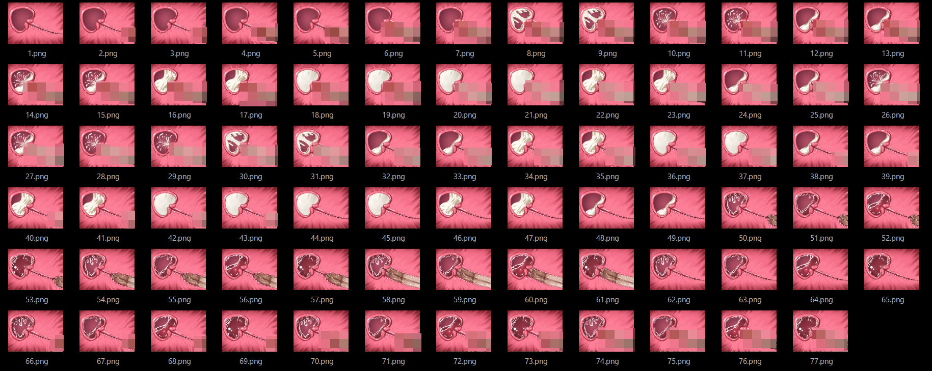 膣内断面図素材2 (dcg jp-005)