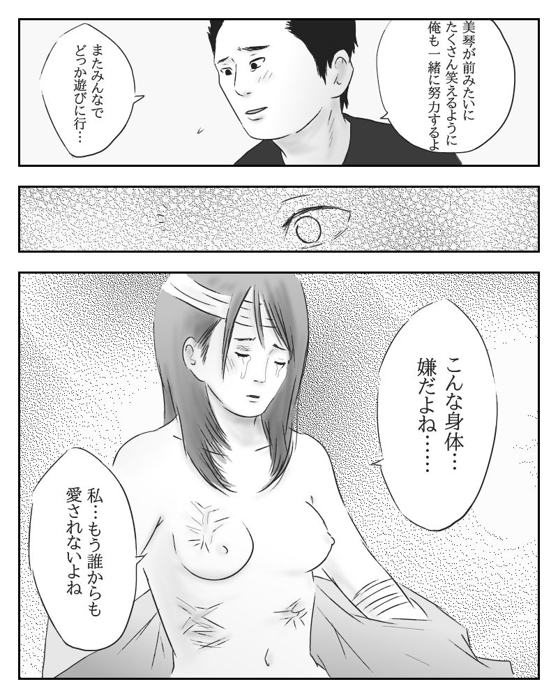 サンプル画像2:愛と真心と火傷 [作品ID:d_133277]