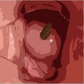 サンプル画像2:わたしの蟲姦遊び 第8話 大きいミズアブの幼虫編 全編(シングルママの日常) [d_280983]