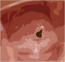 サンプル画像3:わたしの蟲姦遊び 第8話 大きいミズアブの幼虫編 全編(シングルママの日常) [d_280983]