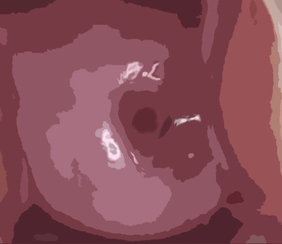 サンプル画像2:私の蟲姦遊び 第10話 妊娠中にウジ虫編(シングルママの日常) [d_284938]