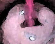 サンプル画像4:私の蟲姦遊び 第10話 妊娠中にウジ虫編(シングルママの日常) [d_284938]