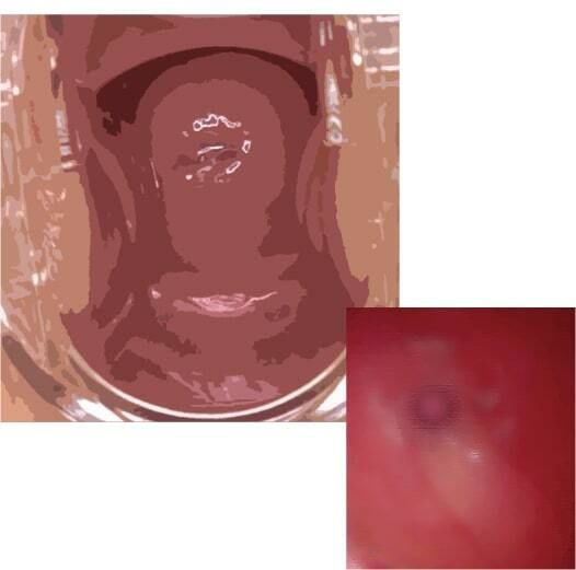 サンプル画像5:私の蟲姦遊び 第11話 妊娠中にカミキリ虫の幼虫とゴキブリの卵編 全編(シングルママの日常) [d_290207]