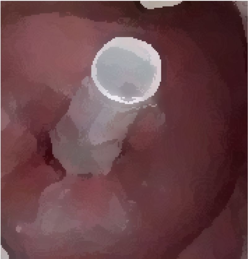 サンプル画像6:私の蟲姦遊び 第16 話 妊娠中にオオキベリアオゴミムシ編(シングルママの日常) [d_302436]