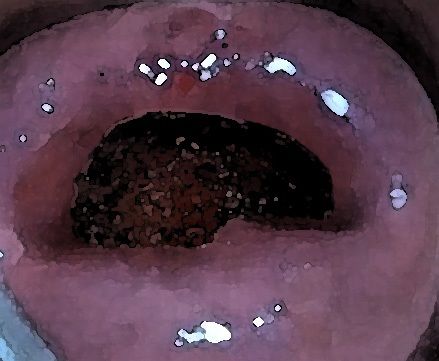 サンプル画像4:私の蟲姦遊び 17 話 妊娠中にスズメガのサナギ編(シングルママの日常) [d_306916]