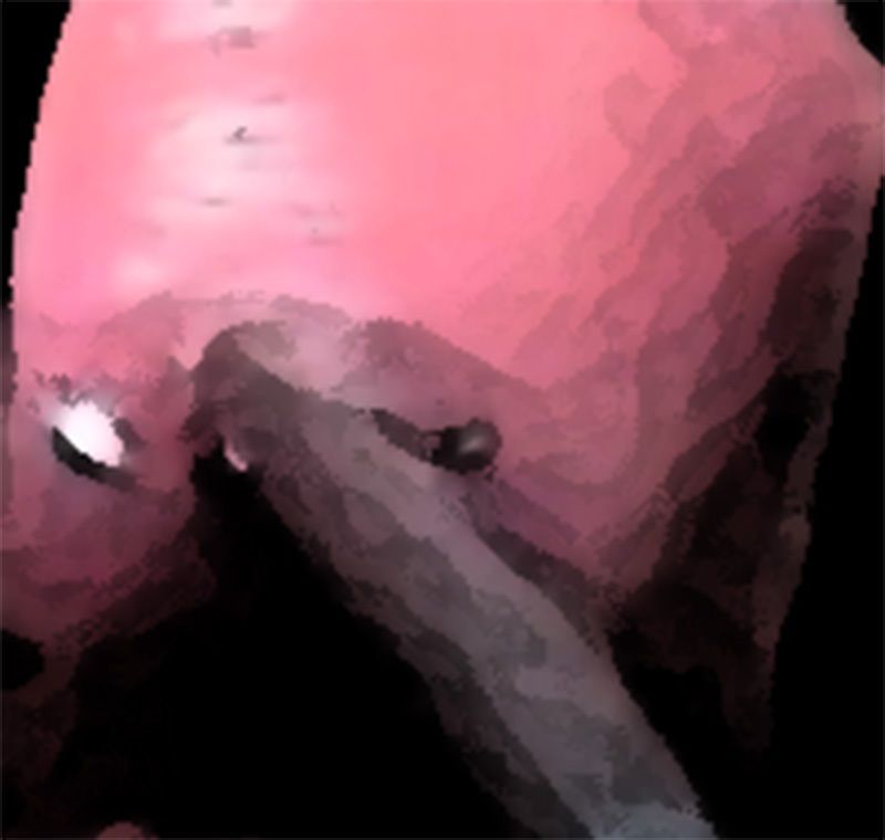 サンプル画像3:私の蟲姦遊び 18話 妊娠中に5 匹のミズアブの幼虫編(シングルママの日常) [d_308962]