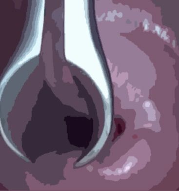 サンプル画像5:私の蟲姦遊び 21 話 妊娠中に3匹のユムシ編 全編(シングルママの日常) [d_322947]