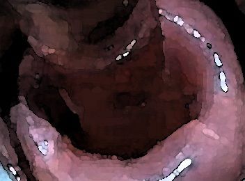 サンプル画像4:私の蟲姦遊び 22話 妊娠中にハサミムシ編 全編(シングルママの日常) [d_323965]