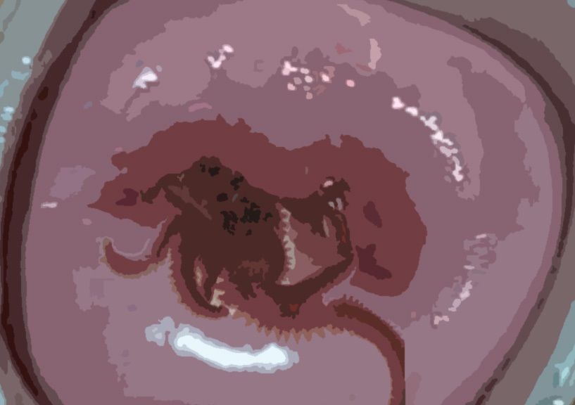 サンプル画像4:私の蟲姦遊び 24話 妊娠中に釣り餌のアオイソメ編(シングルママの日常) [d_329043]