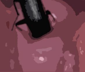 サンプル画像4:私の蟲姦遊び 25話 妊娠中にベランダにいたゴミムシ編(シングルママの日常) [d_334202]