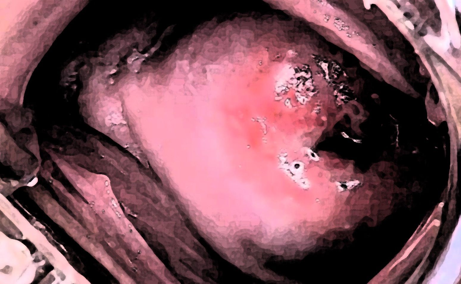 サンプル画像6:私の蟲姦遊び 27話 妊娠中にジャンボタニシの卵編(シングルママの日常) [d_462593]