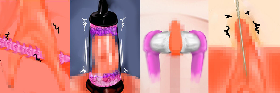 サンプル画像4:『清純な女子〇〇〇を監禁し陰核と尿道をグチャグチャに責め抜き、ズル剥け勃起クリトリスと敏感尿道で一生まともに排尿も生活もできなくして人生終了させる』【後編】(淫乱テディベア) [d_482160]