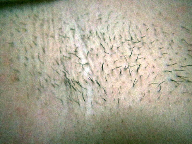 C-01784 Bagian 17 - 78 minit