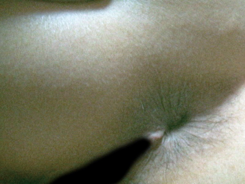 C-01809 第 14 部分 - 82 分钟