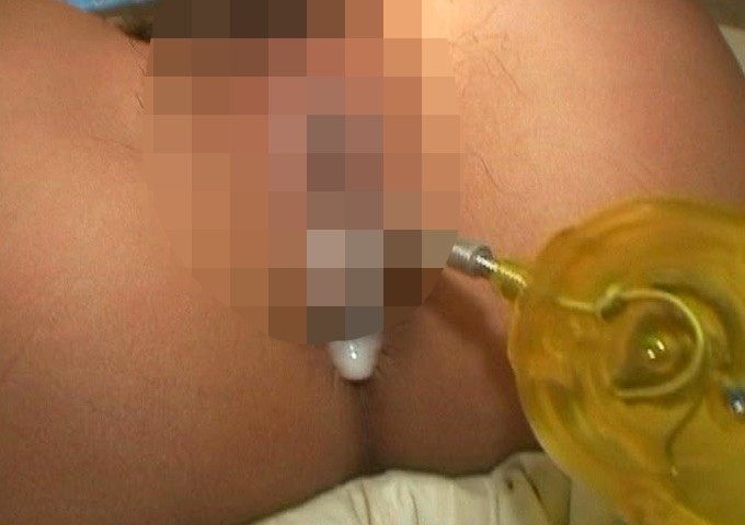 ALD-450 Bagian 14 - 186 minit