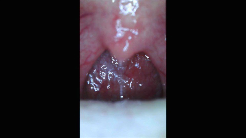 XRW-957 パート 10 - 120 分