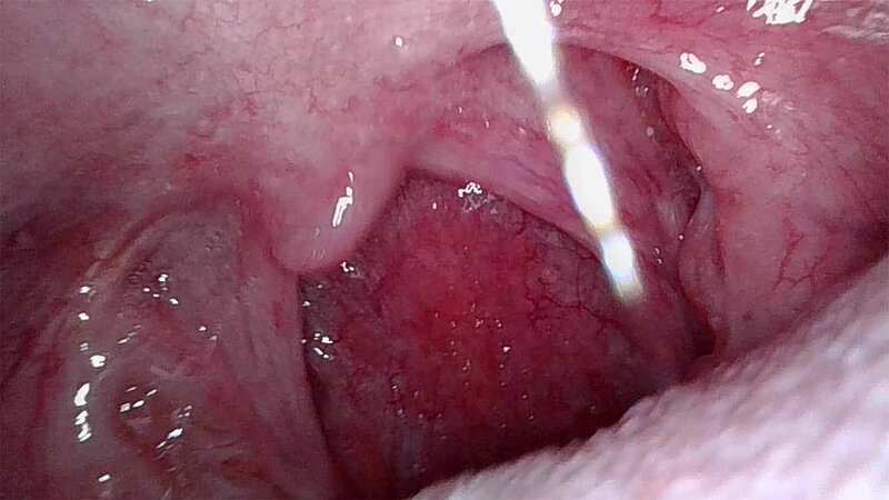 DRPT-099 第 11 部分 - 70 分钟