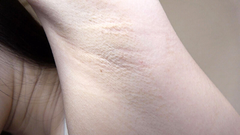 OKS-142 Part 1 - 30 minutes