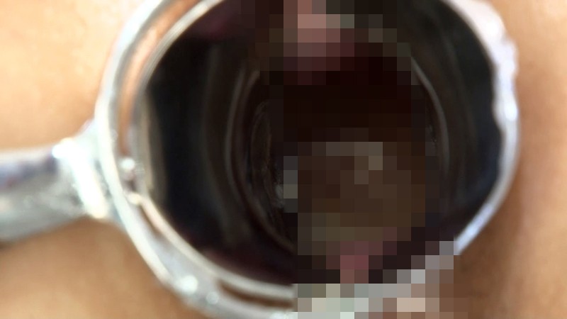 RCT-517 Bagian 9 - 94 minit