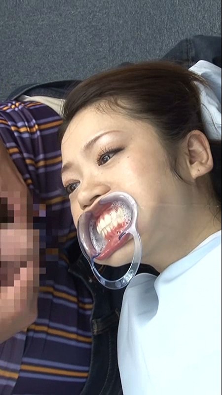 TRCT-300 第 10 部分 - 84 分钟