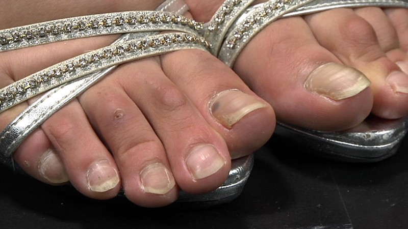 FETI-154 Part 10 - 138 minutes