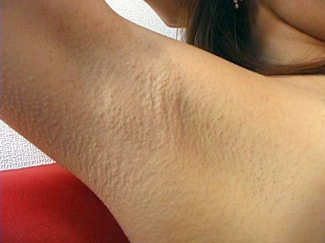 ESR-014 第 10 部分 - 75 分钟