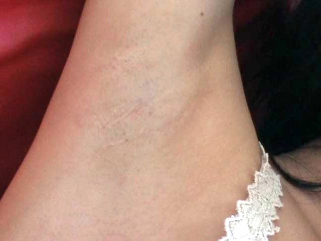 ESR-014 第 8 部分 - 65 分钟