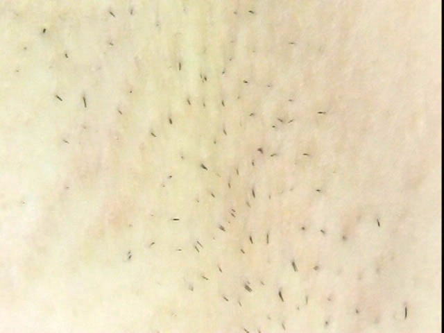 GA-053 Bagian 18 - 81 minit