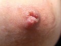 100人の乳首 第1集 - FANZA版サンプル画像