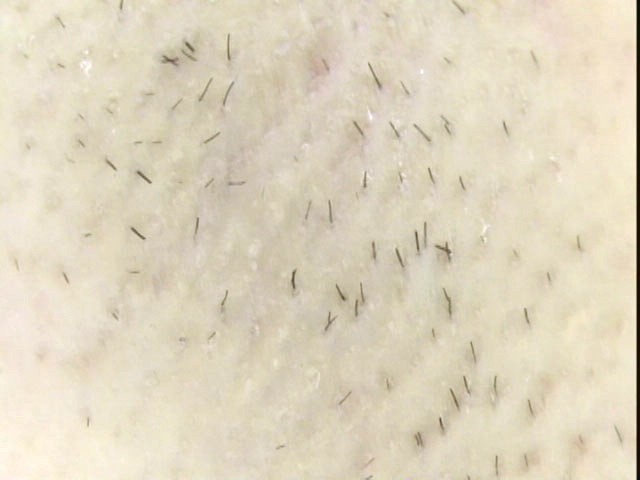 GA-098 Part 10 - 57 minutes