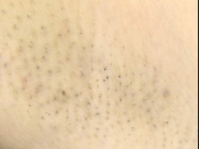 GA-098 Bagian 12 - 63 minit