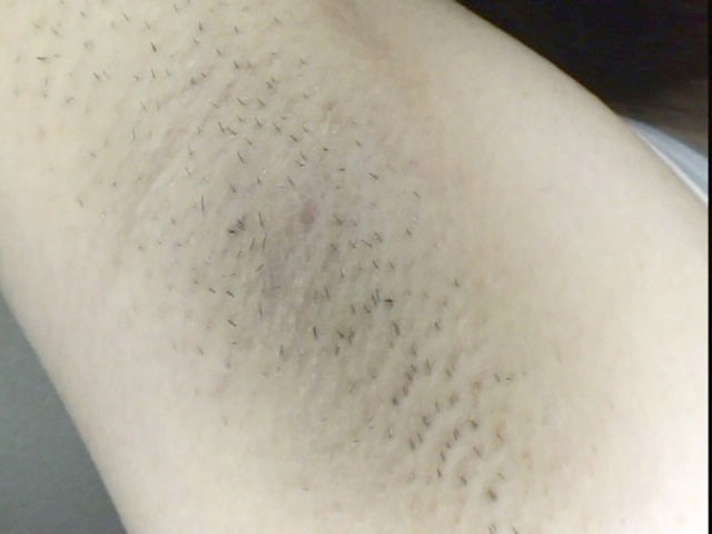 GA-098 Part 6 - 45 minutes