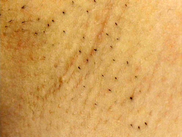 GA-104 Bagian 13 - 78 minit