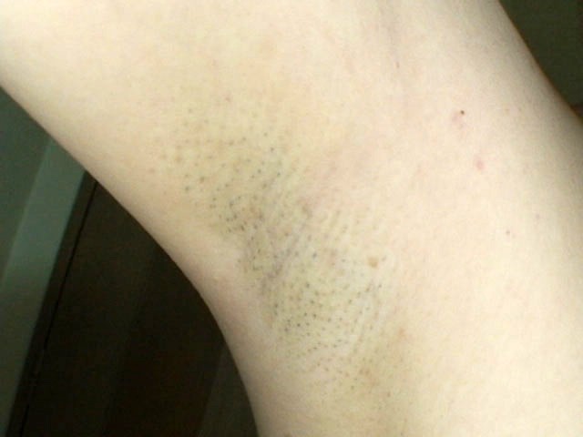 GA-104 Part 17 - 94 minutes