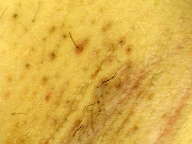 GA-104 Part 18 - 98 minutes