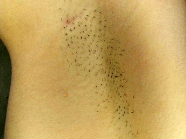 GA-104 Part 19 - 102 minutes