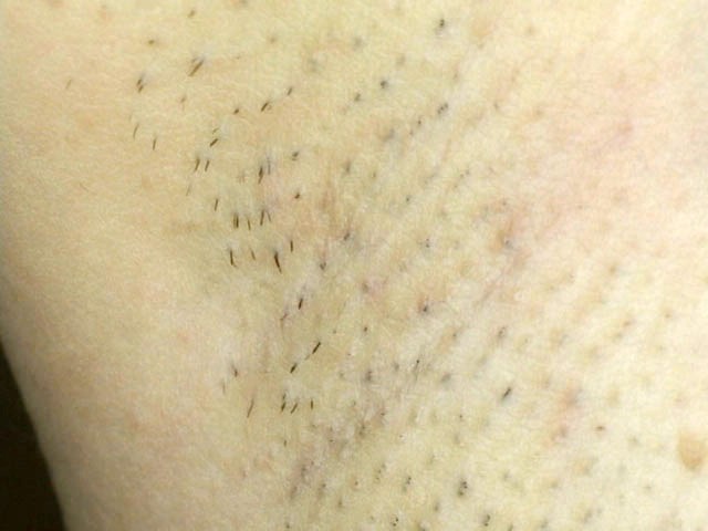 GA-104 Part 20 - 106 minutes