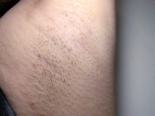 GA-118 第 12 部分 - 85 分钟