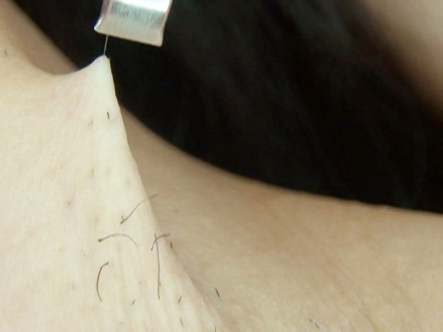 GA-118 第 9 部分 - 70 分钟