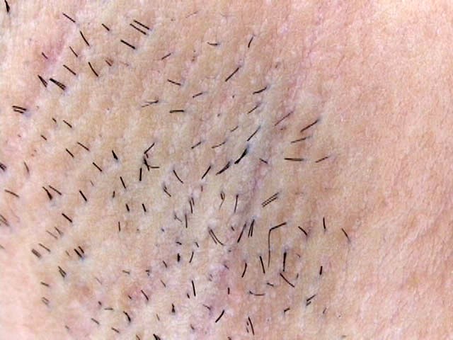 GA-188 Part 1 - 30 minutes