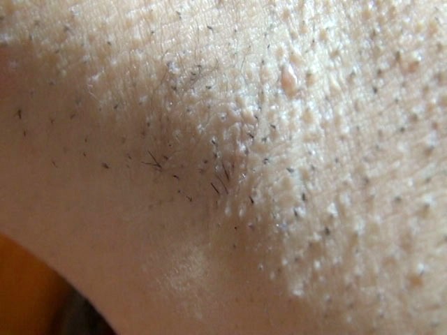 GA-188 Part 10 - 75 minutes