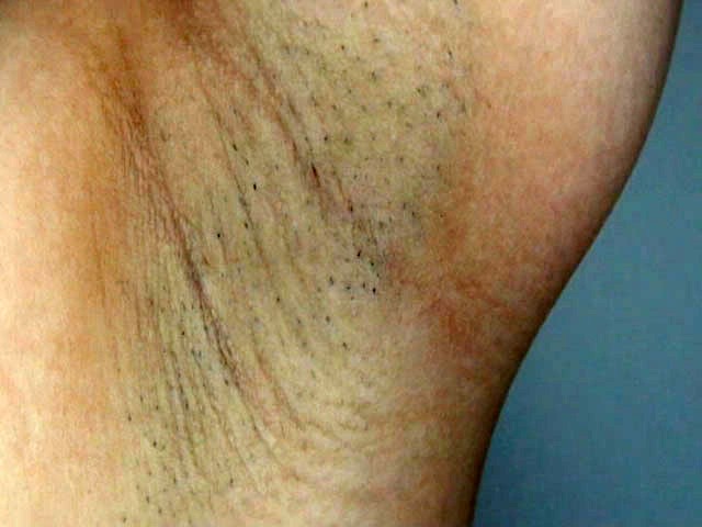 GA-188 Part 11 - 80 minutes