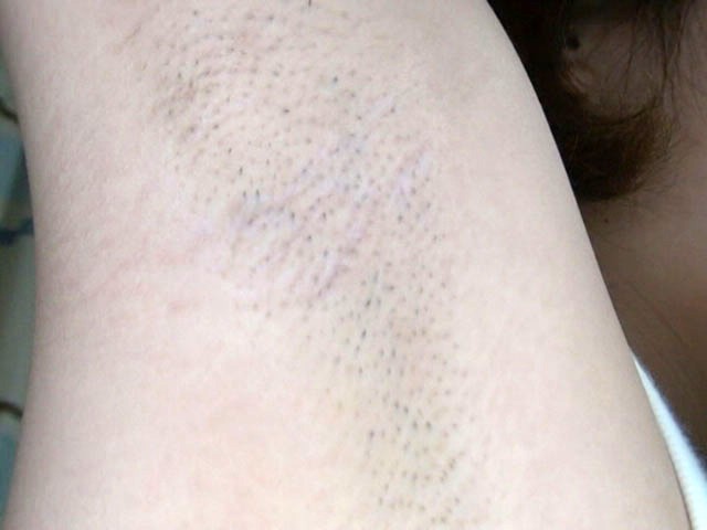 GA-188 Part 12 - 85 minutes