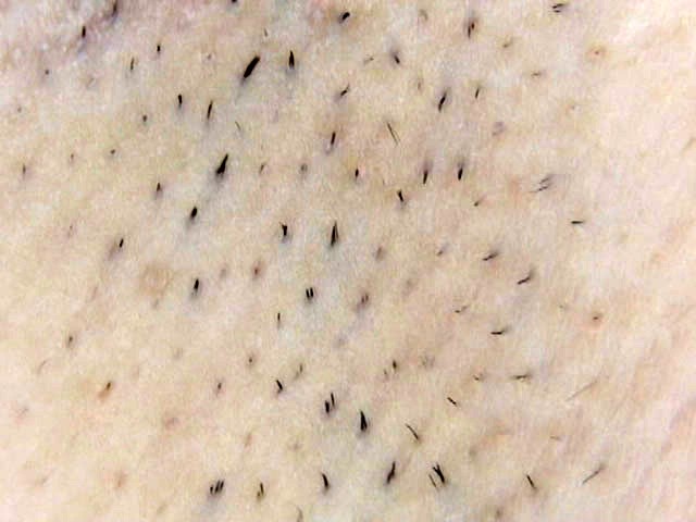 GA-188 第 13 部分 - 90 分钟