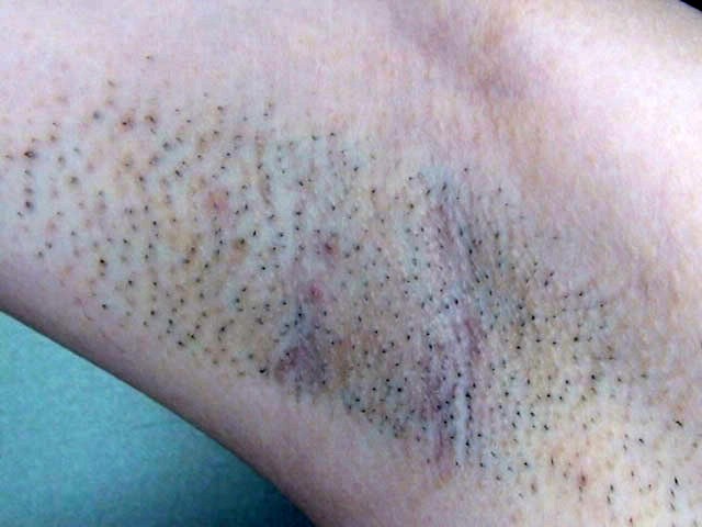 GA-188 第 14 部分 - 95 分钟