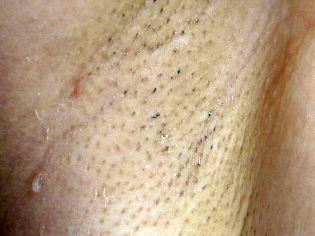 GA-188 Part 3 - 40 minutes