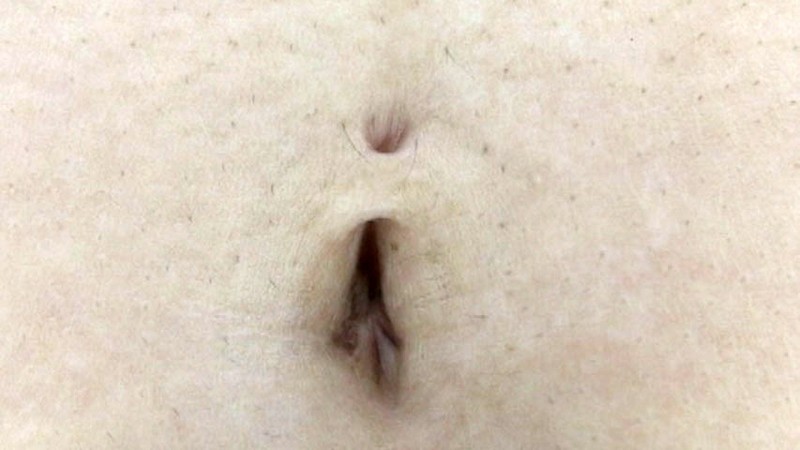 GA-201 パート 13 - 78 分